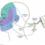 trigeminal-complex-300×221