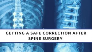 Getting a Safe Correction after Spine Surgery