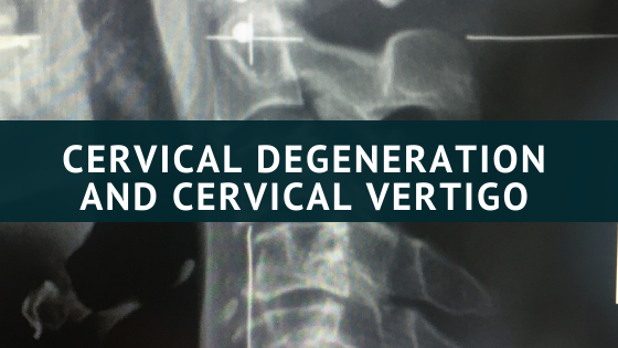 Cervical Degeneration and Cervical Vertigo